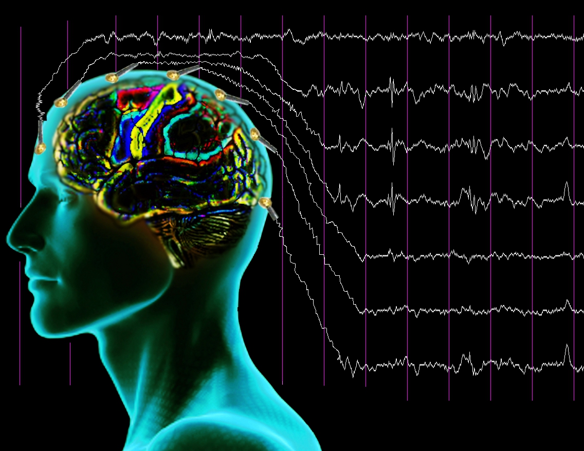 В СГТУ начал работать центр по изучению нелинейной динамики процессов головного мозга и сердца